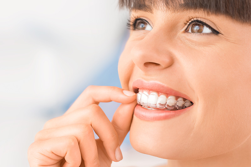 Invisalign in Plano